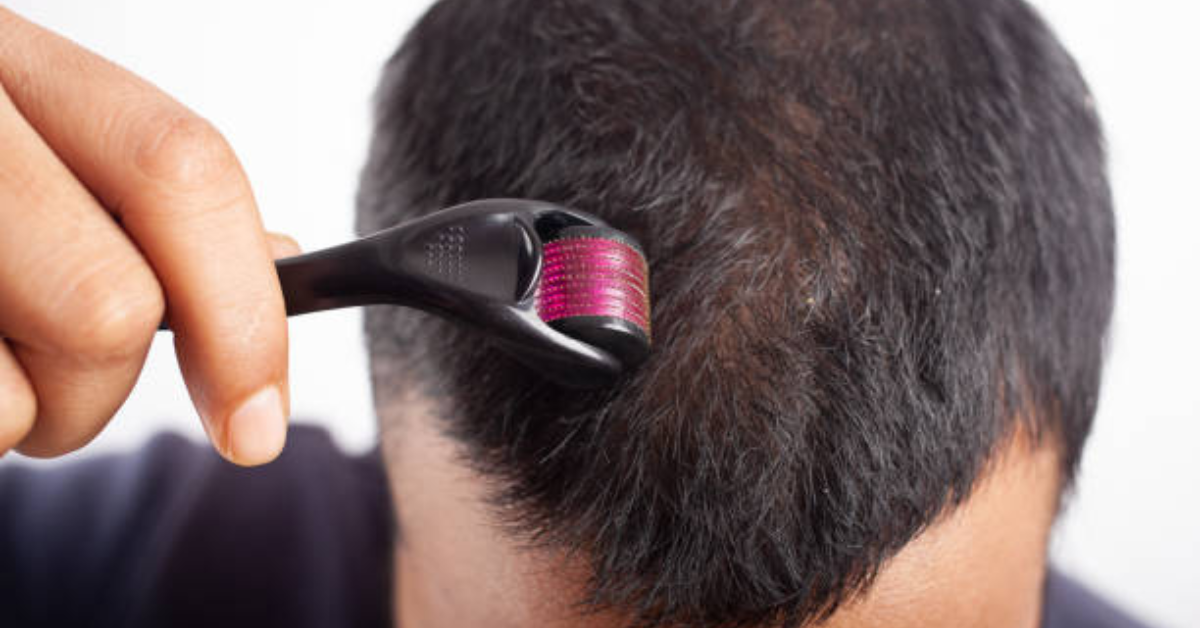 Derma Roller for Hair Loss
