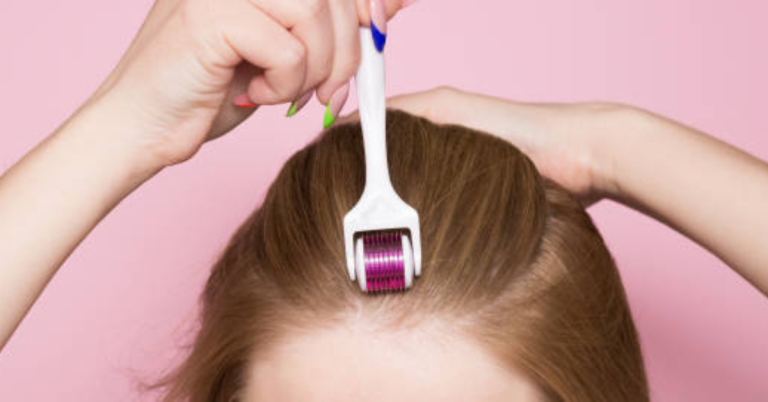 How to Choose the Best Derma Roller for Hair Growth