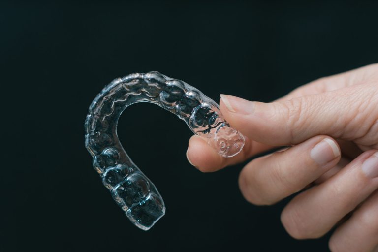 What Are the Best Alternatives to Dental Braces in Thousand Oaks, CA?