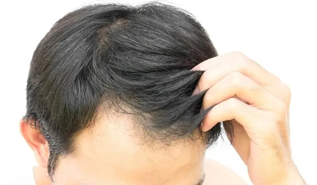 hair fall treatment