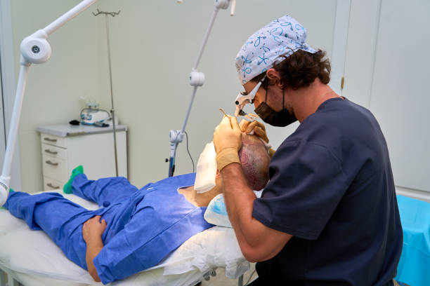 What Age Is Best for a Hair Transplant? Doctors Weigh In