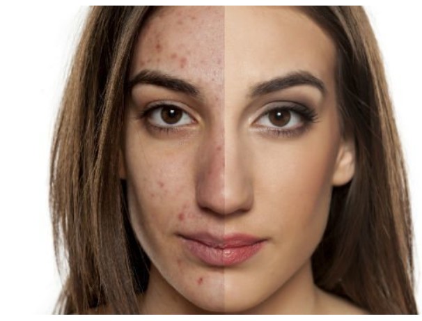 skin cancer treatment Long Beach CA